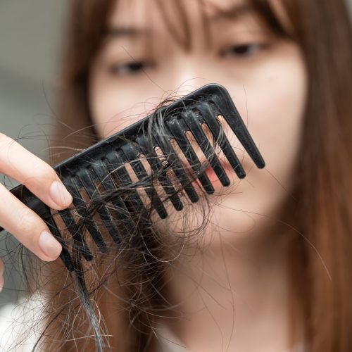 Asian woman have problem with long hair loss attach to comb brus Asian woman have problem with long hair loss attach to comb brush.
